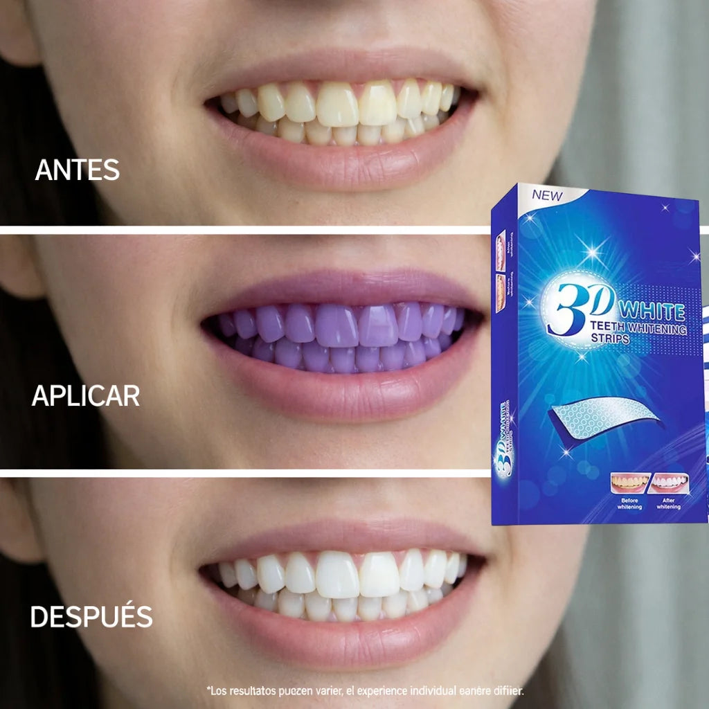 Tiras blanqueadoras de dientes