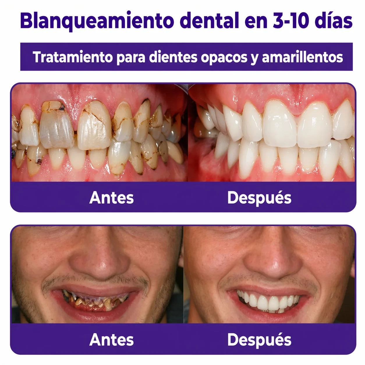 Polvo Dental Mineral Reparador y Blanqueador